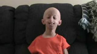 Progeria - An unneeded suffering without a cause
