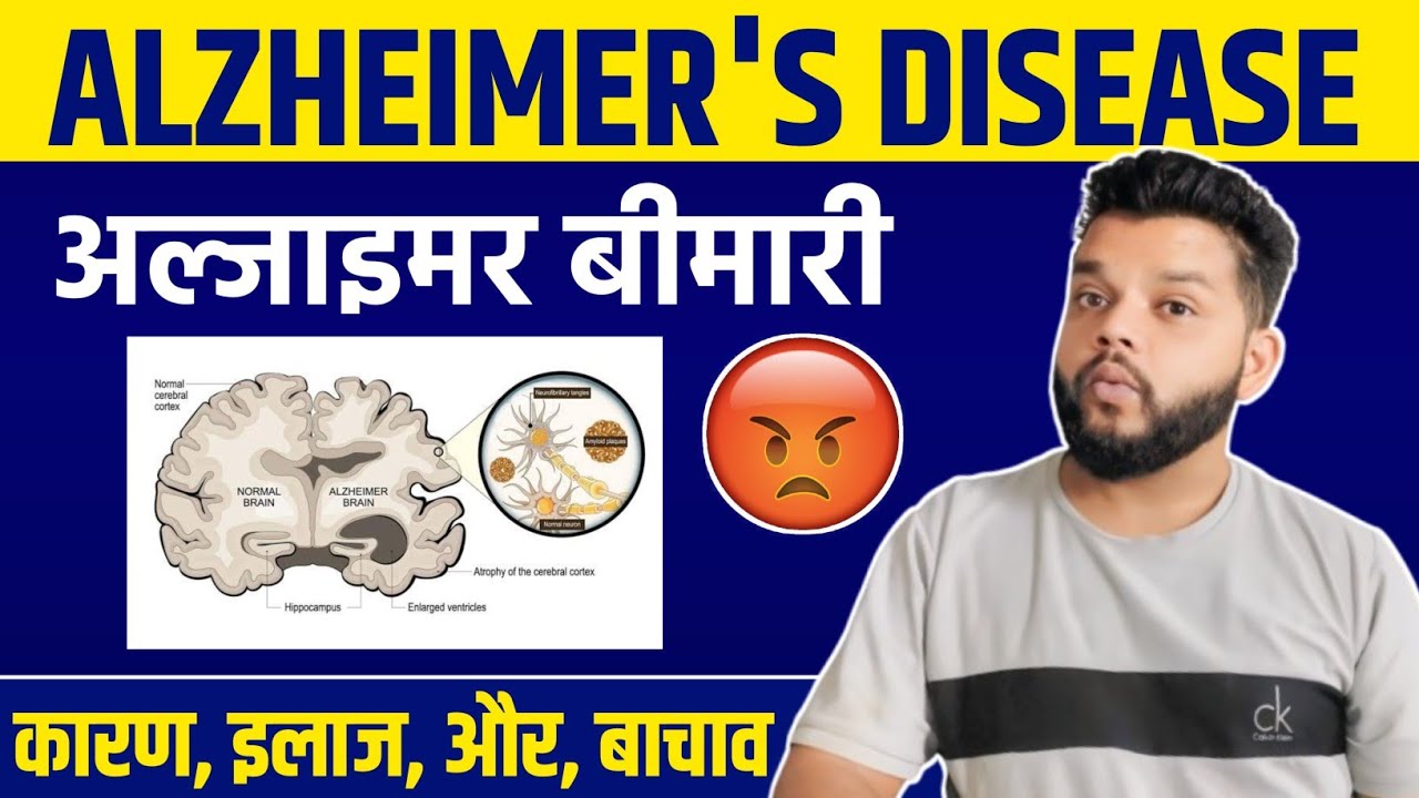Alzheimer's Disease In Hindi | Alzheimer's Disease Symptoms,Causes & Treatment