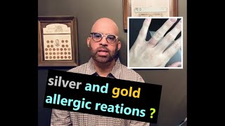 what caused allergic reaction in jewelry ( how to prevent )