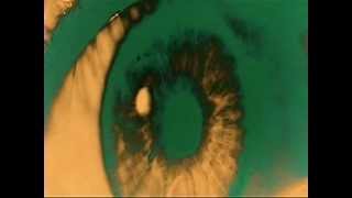 fluxion - bipolar defect (trailer)