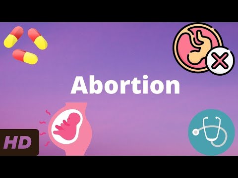 Abortion: Everything You Need To Know