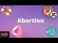 Abortion Everything You Need To Know
