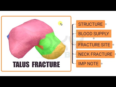 ORTHOPAEDICS- Talus Fracture -1