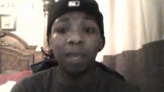 James Fauntleroy- Allergic To You