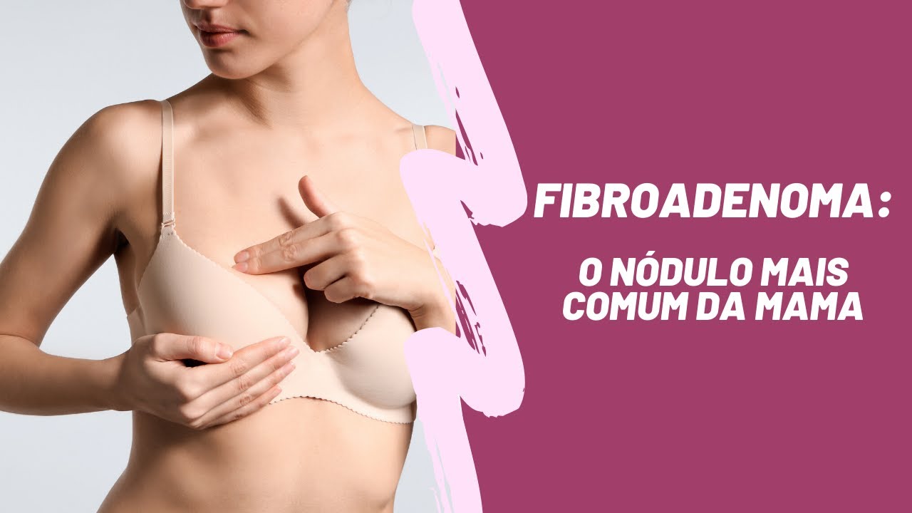 Douglas Soltau Gomes-20