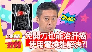 免開刀也能治肝癌，使用「電燒」就能解決？！【醫師好辣】20191118 part2 EP846 洪永祥 謝忻