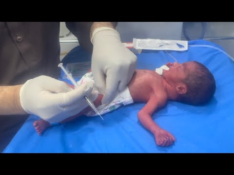 850g Preterm Baby Vitamin K Injection & First NG Feeding | Sumaira Kousar