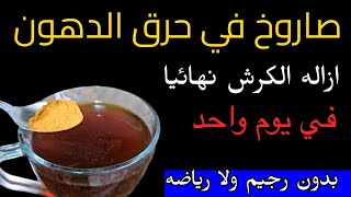 معلقة واحدة بس ودهون البطن بتسيح ❗️اشربي ده قبل النوم❗️ وشوفي الكرش بينزل لوحده #طبيعي_وبس