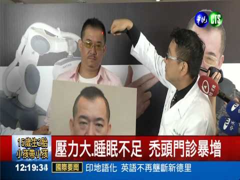 現代人生活緊張 壓力型掉髮增3成