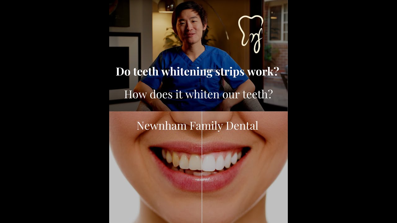Do teeth whitening strips work