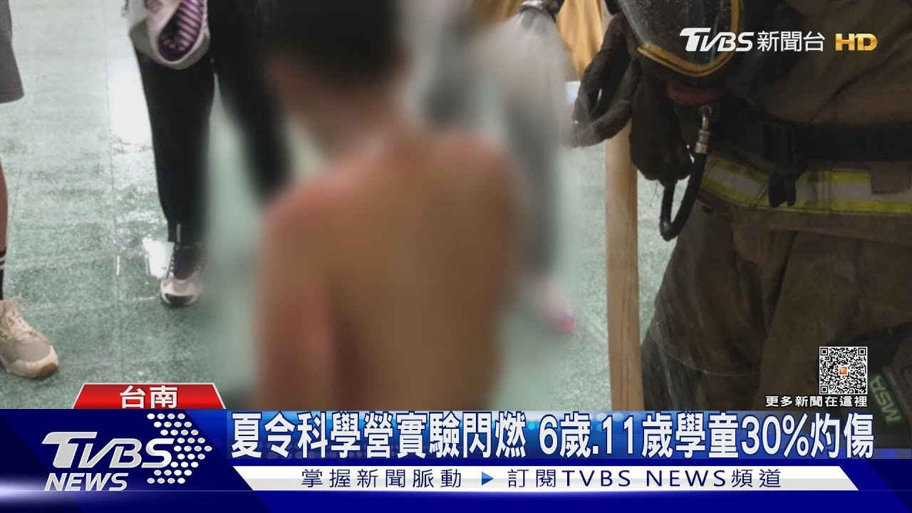 嚇哭!夏令科學營實驗閃燃6歲、11歲學童30%灼傷