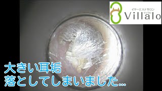 耳掃除動画vol.60「大きな耳垢 落としてしまいました」