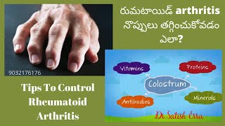 రుమటాయిడ్ Rheumatoid Arthritis లో Swelling వాపులు, నొప్పులు Pain తగ్గించుకోండి | Dr.Satish Erra's Homeo