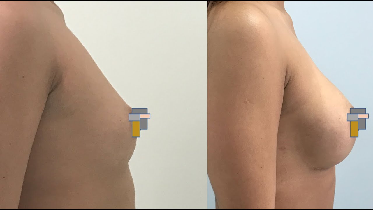 José Cortés Arreguin-43