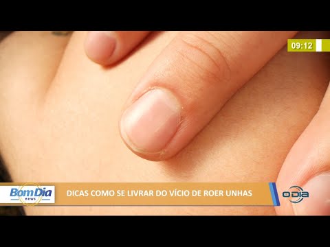 Dicas de como se livrar do viÌcio de roer as unhas 12 08 2021