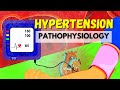 The Pathophysiology Of Hypertension