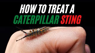 how to treat a caterpillar sting | how to cure caterpillar sting