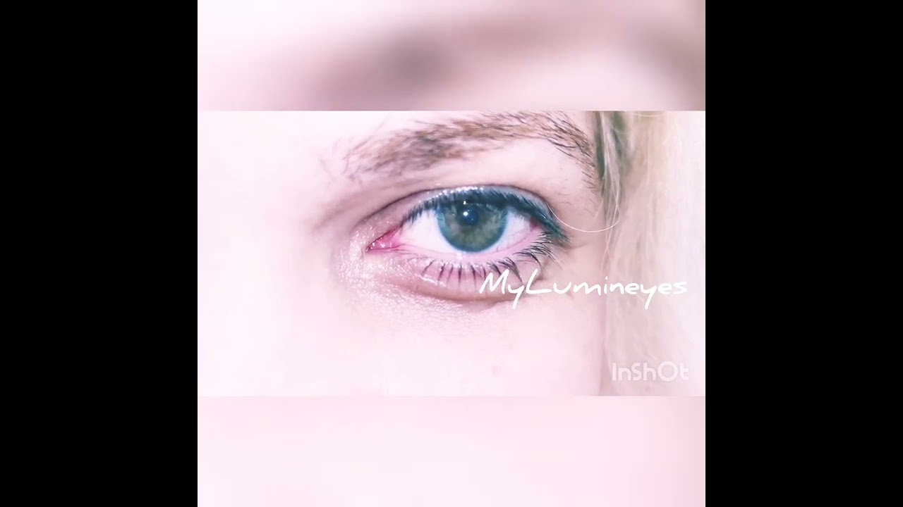 Chirurgie du changement de couleur des yeux Türkiye de façon permanente