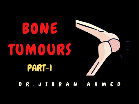 RHEUMATOID ARTHRITIS II BONES AND SOFT TISSUE II ARTHRITIS II ROBBINS 10TH E II PATHOLOGY LECTURES