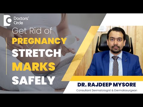 Prevention & Treatment Of Stretch Marks During Pregnancy#skincare -Dr.Rajdeep Mysore|Doctors' Circle
