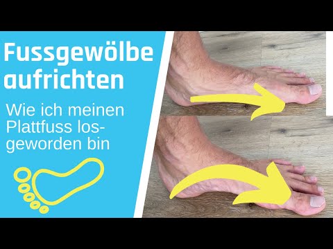 Fussgewölbe aufrichten - Plattfuss für immer loswerden (kurzer Fuß nach Janda Übungen)