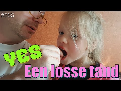 download lagu mp3 mp4 Losse Tand, download lagu Losse Tand gratis, unduh video klip Losse Tand