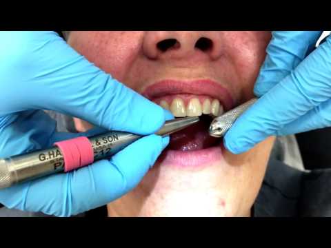 So überprüfen Sie die Mobilität