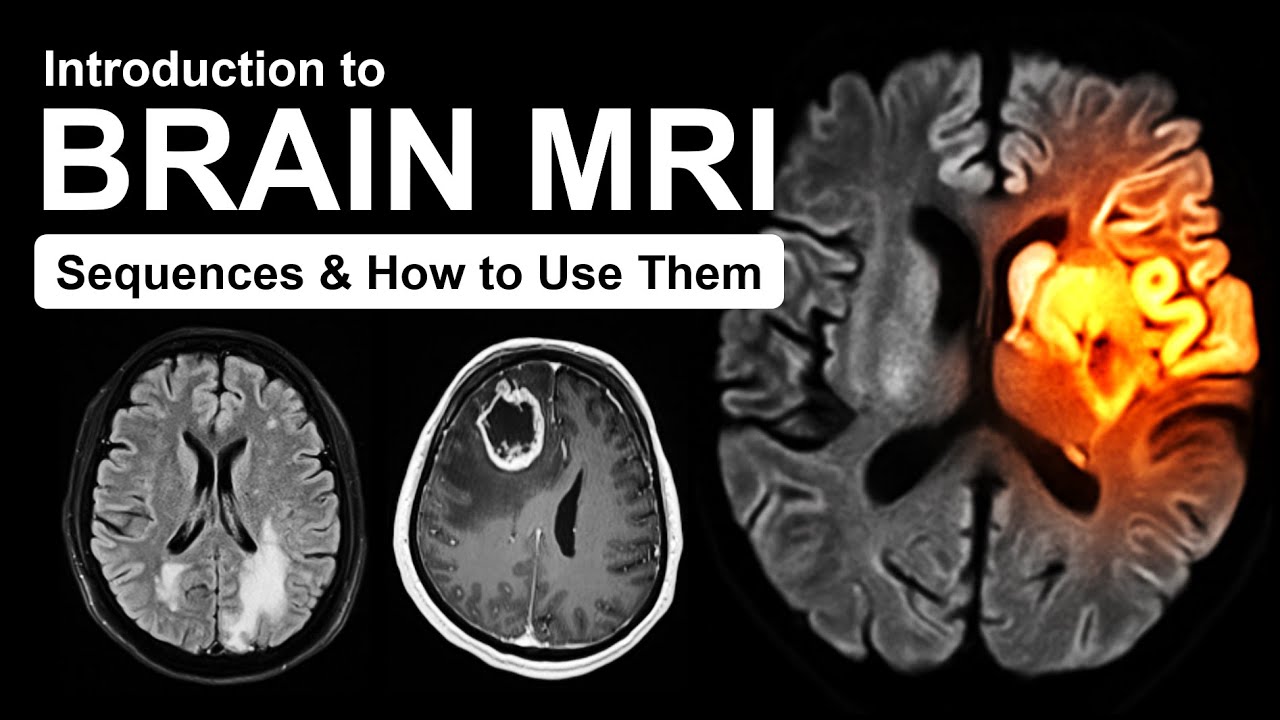 Introduction to Brain MRI: Routine Sequences and How to Use Them