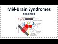 Mid-Brain Syndromes | Weber Syndrome | Benedikt Syndrome | Parinaud's Syndrome