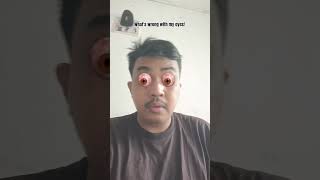 what's wrong with my eyes #funny #duet #stitchtricks #comedy #stitchboutique 
