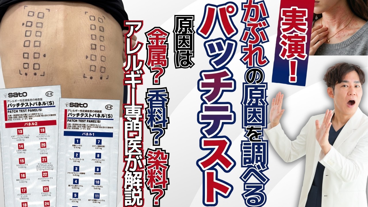 【パッチテストとは？】【検査動画あり】ダブル専門医（皮膚科・アレルギー）がパッチテスト検査の流れを徹底解説！