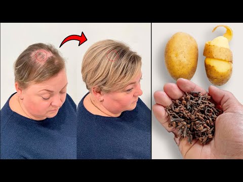 +10cm hair growth in 16 days on a bald spot! Hair grows like crazy!