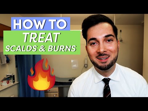 Burns | How To Treat Burns | How To Treat A Burn