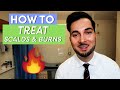 Burns | How To Treat Burns | How To Treat A Burn