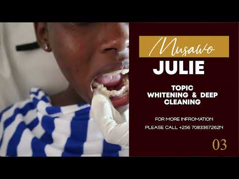Okutukuza amanyo (teeth whitening)