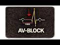 AV BLOCK Simple Memory Aids