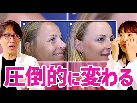 シワは消えましたか?一部のアンチエイジング方法はひどい結果に終わる可能性があります