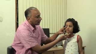 Lacrimal Massage to stop watering eye in children 