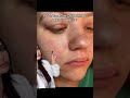 Do You Have OILY SKIN LARGE PORES Skincare Skincareroutine