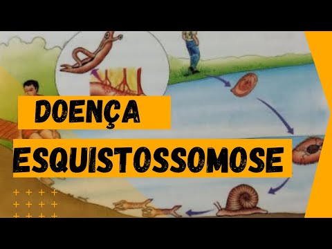 Schistosomiasis - Schematic Summary