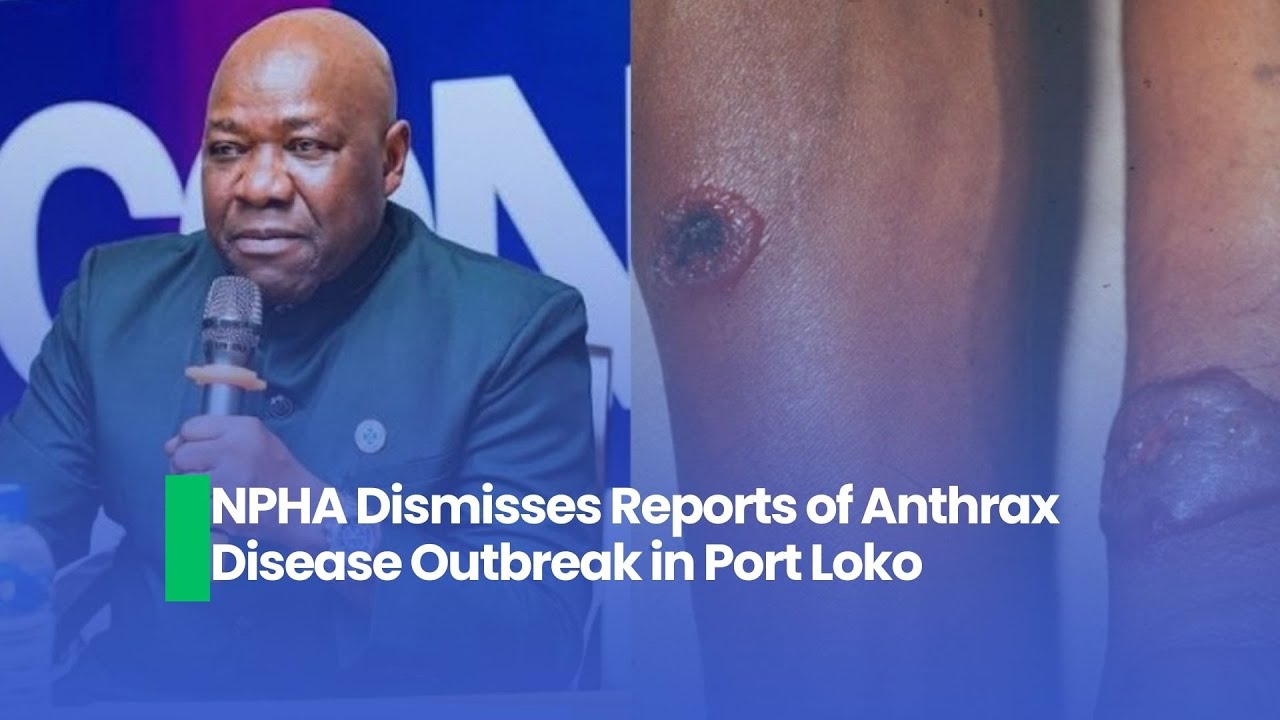 NPHA Dismisses Reports of Anthrax Disease Outbreak in Port Loko