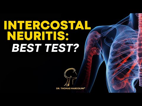 Intercostal Neuralgia Diagnosis, Find Out Now!