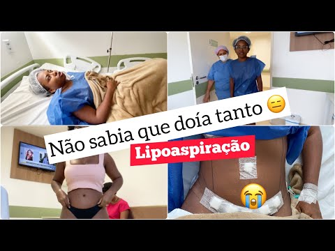LIPOASPIRAÇÃO relato real/Minha experiência😬