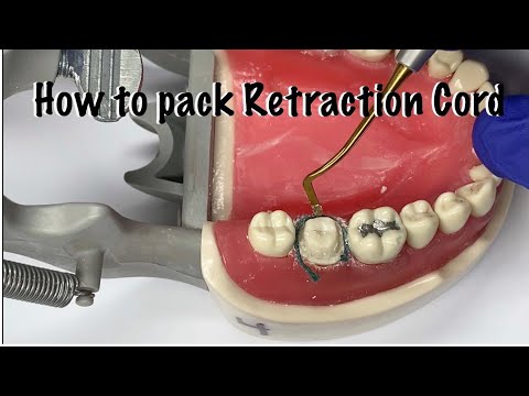 Packing Retraction Cord on a Tooth Prepped for a Crown