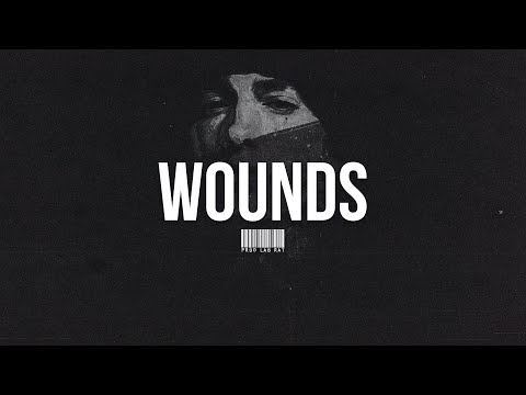(Free) Eminem x SHADY x STORYTELLING Type Beat | “WOUNDS”