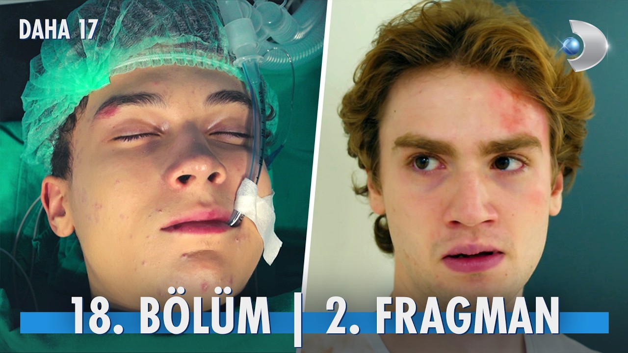 Daha 17 18. Bölüm 2. Fragmanı