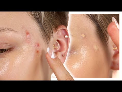 Let's cover these up