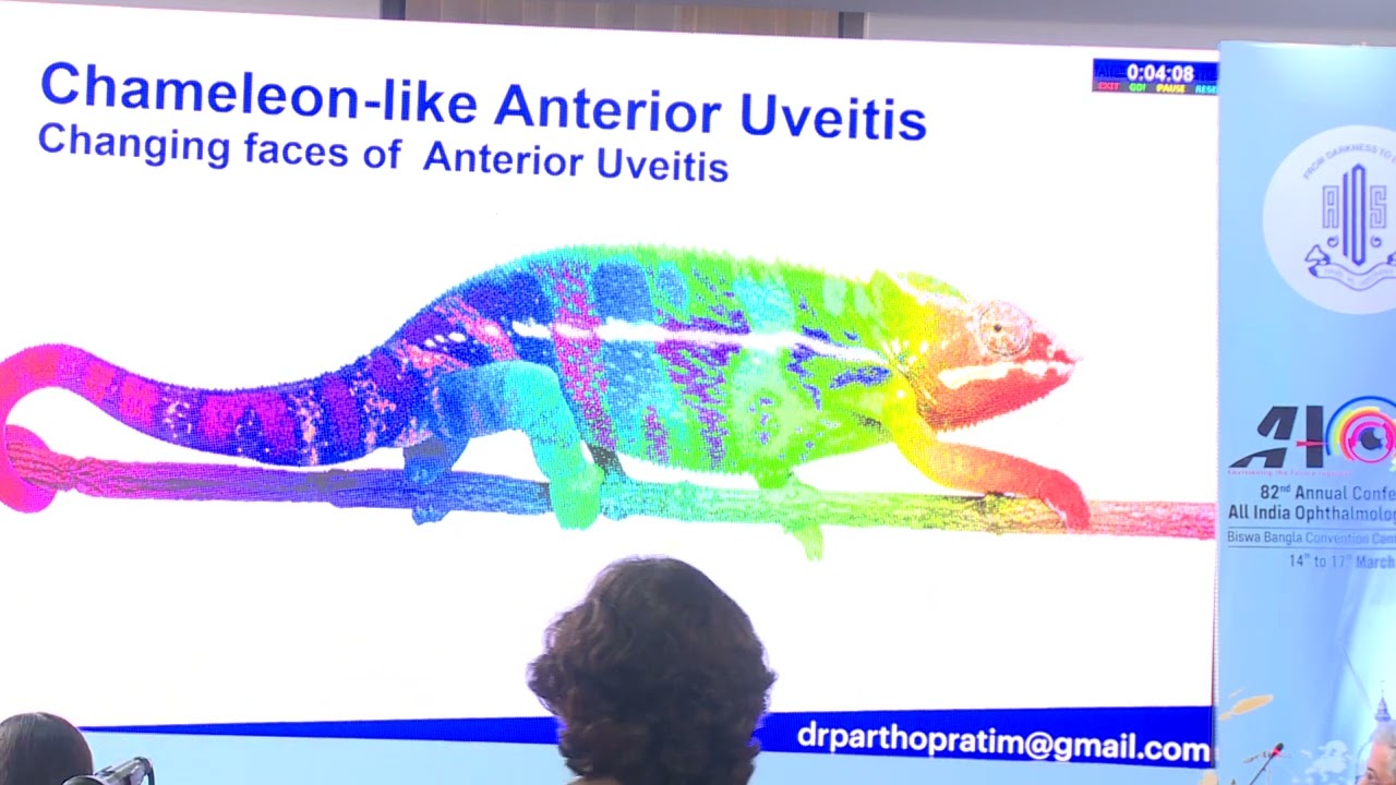 Anterior uveitis Don't think so simple
