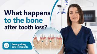 What Is Bone Grafting?