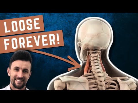 How to Permanently Loosen Tight Scalenes